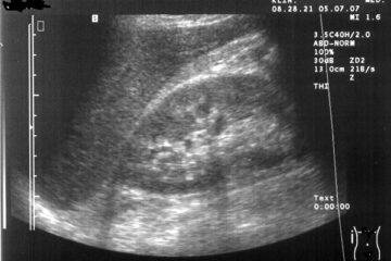 Decadenza Potesta Genitoriale Cos E