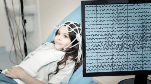 Что такое электроэнцефалограмма?