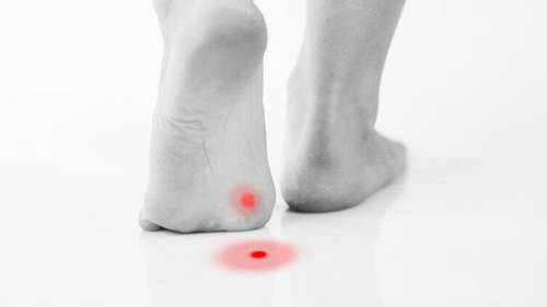 Что такое шипица и как от нее избавиться?