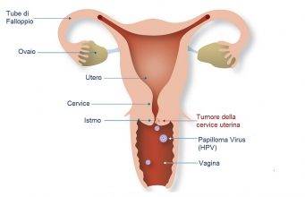 hpv si herpes genital papilomele cum vă puteți infecta